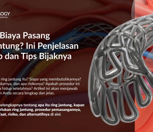 Pasang Ring Jantung (Stent): Biaya, Proses, dan Apa yang Perlu Anda Siapkan