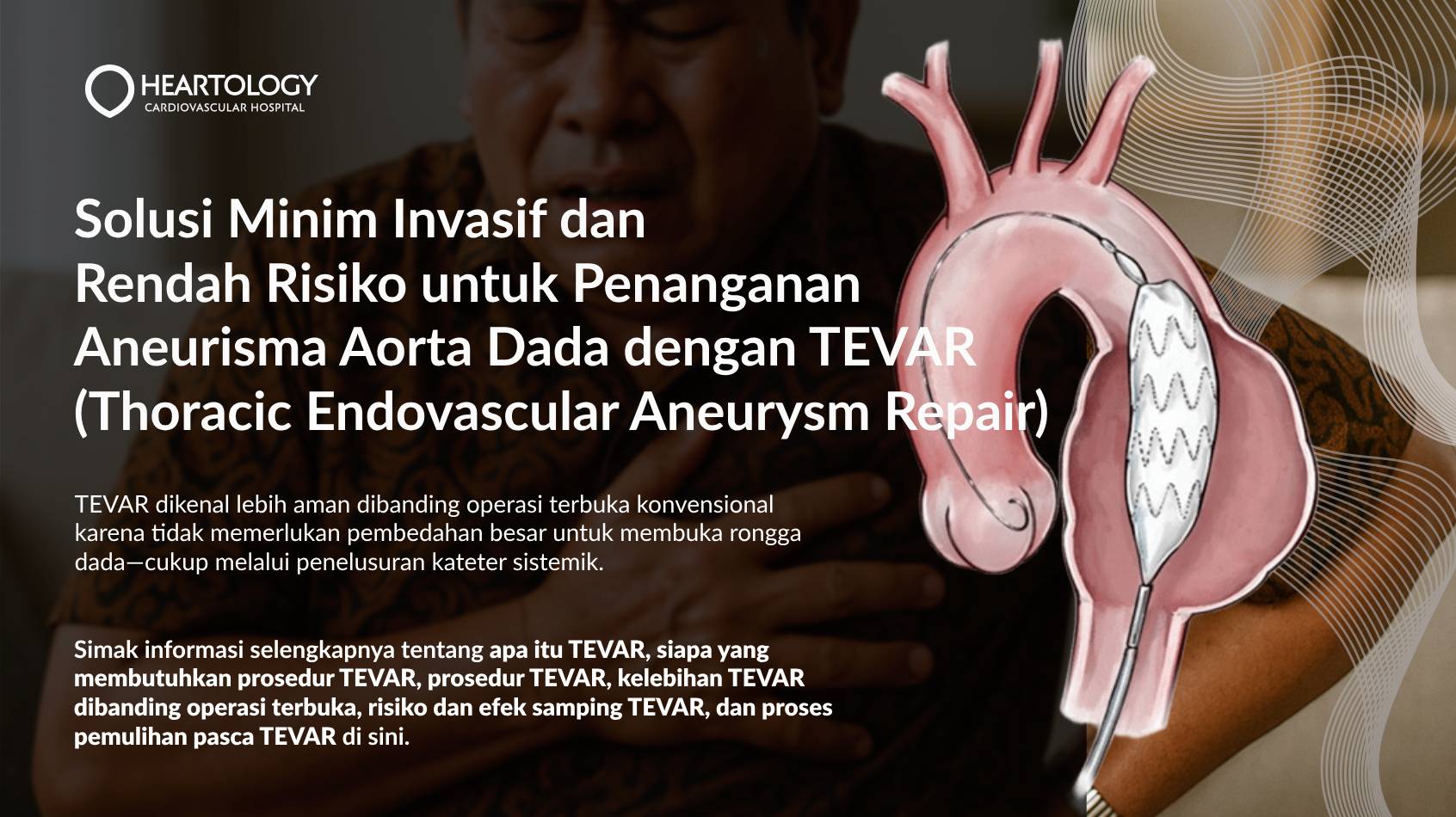 TEVAR (Thoracic Endovascular Aneurysm Repair): Solusi Minim Invasif untuk Aneurisma Aorta Torakalis