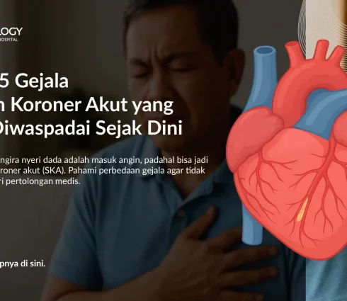 Gejala Sindrom Koroner Akut yang Harus Diwaspadai Sejak Dini