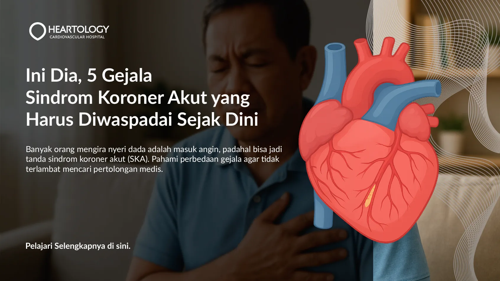 Gejala Sindrom Koroner Akut yang Harus Diwaspadai Sejak Dini