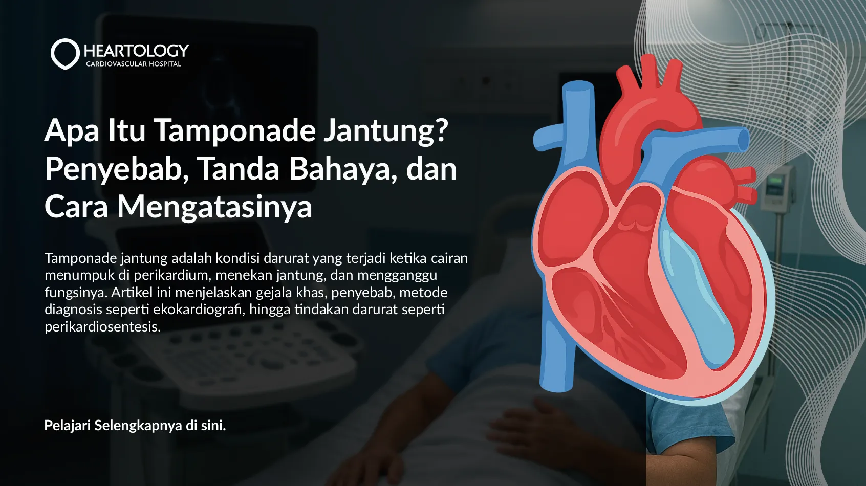 Apa Itu Tamponade Jantung? Penyebab, Tanda Bahaya, dan Cara Mengatasinya