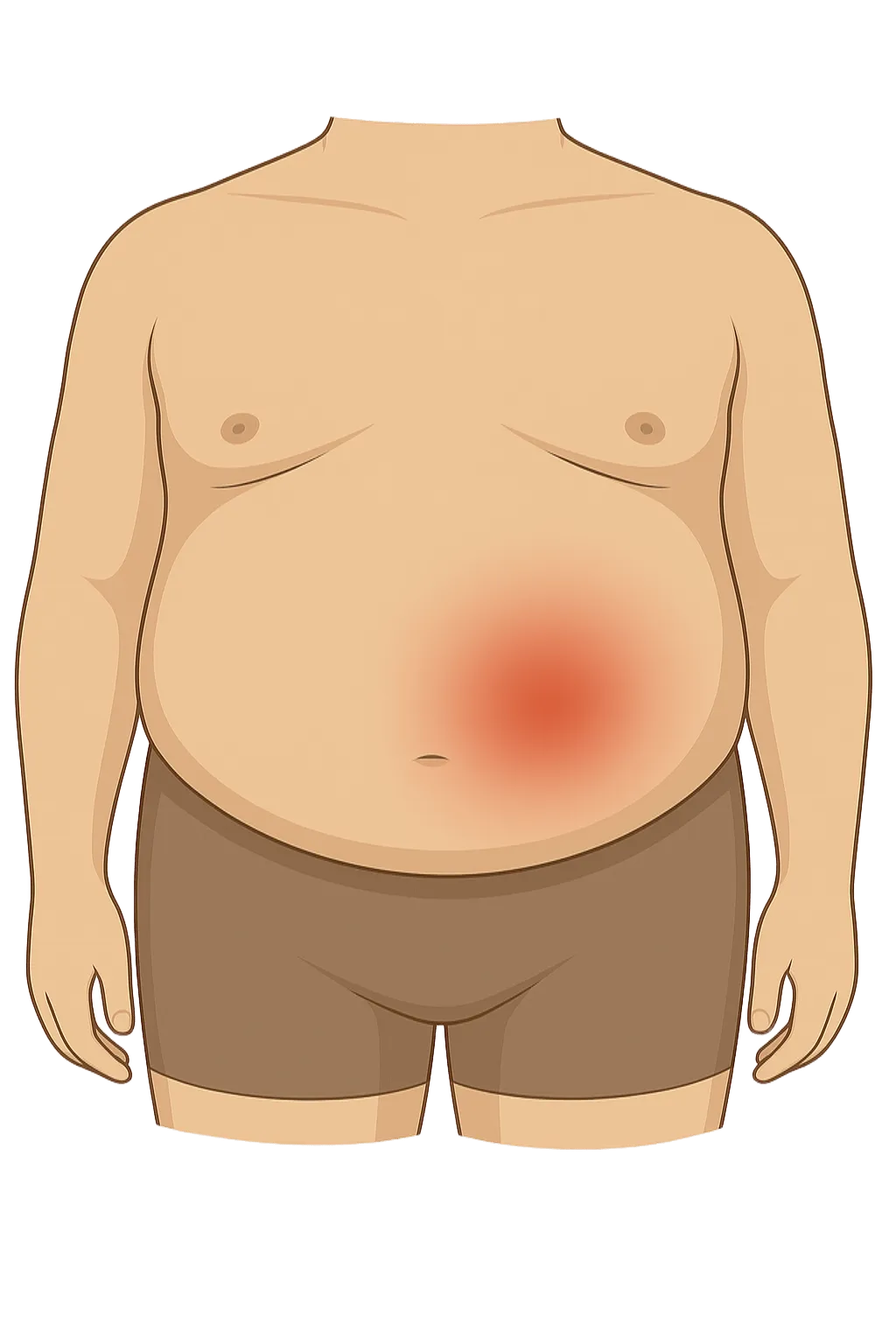 Ilustrasi digital medis memperlihatkan tubuh manusia dengan sorotan warna merah pada perut sebelah kiri bagian bawah, menunjukkan area nyeri perut sebelah kiri.