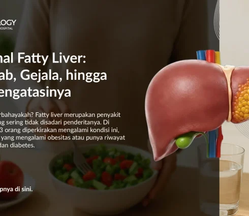 Mengenal Fatty Liver: Penyebab, Gejala, hingga Cara Mengatasinya