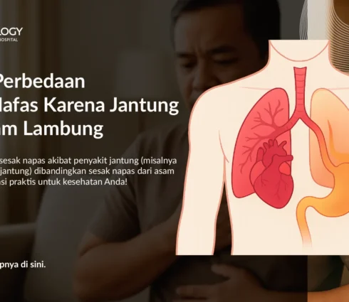 Kenali Perbedaan Sesak Nafas Karena Jantung dan Asam Lambung