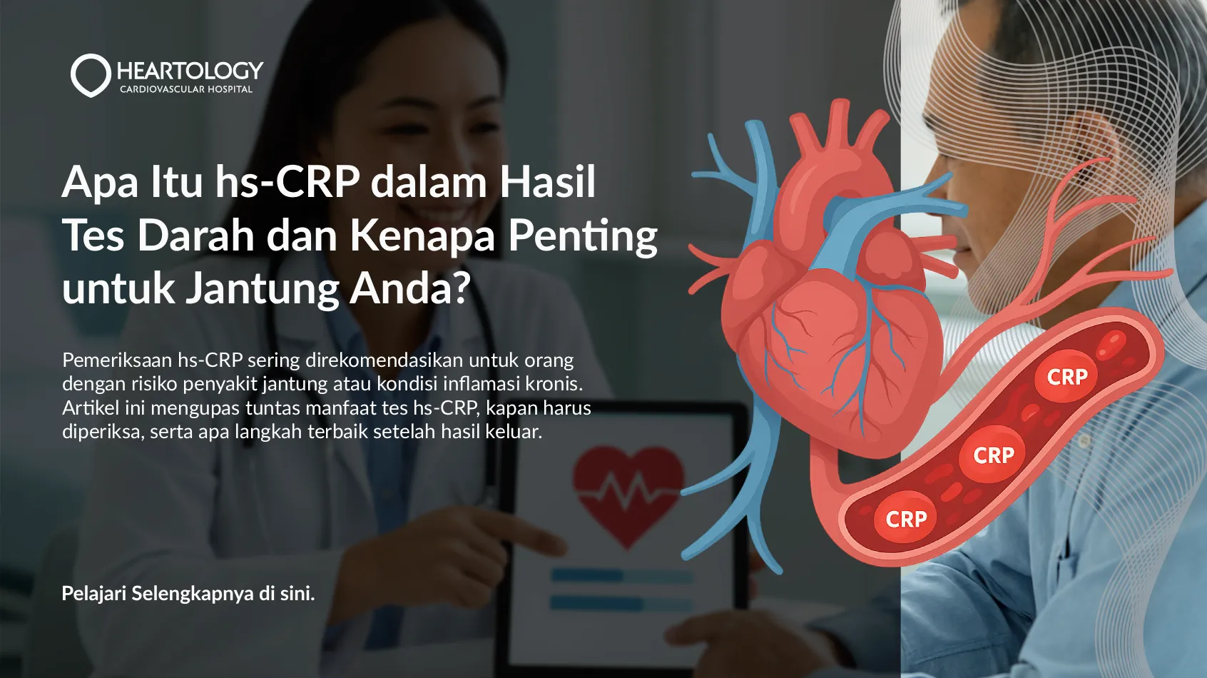 Apa Itu hs-CRP dalam Hasil Tes Darah dan Kenapa Penting untuk Jantung Anda?