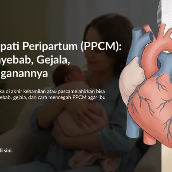Mencegah dan Mengatasi Kardiomiopati Peripartum (PPCM) pada Ibu Hamil