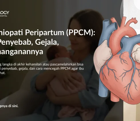 Mencegah dan Mengatasi Kardiomiopati Peripartum (PPCM) pada Ibu Hamil