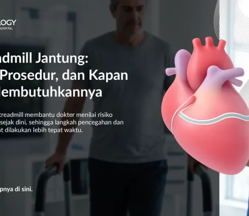 Tes Treadmill Jantung: Fungsi, Prosedur, dan Kapan Anda Membutuhkannya