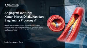Angiografi Koroner: Kapan Harus Dilakukan dan Bagaimana Prosesnya?