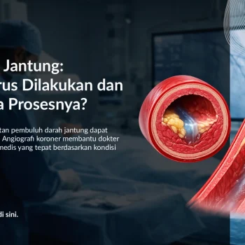 Angiografi Koroner: Kapan Harus Dilakukan dan Bagaimana Prosesnya?