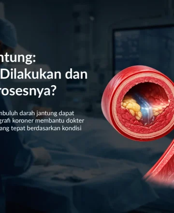 Angiografi Koroner: Kapan Harus Dilakukan dan Bagaimana Prosesnya?