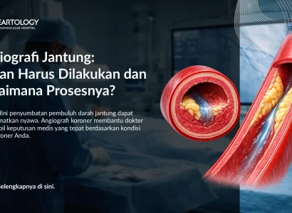 Angiografi Koroner: Kapan Harus Dilakukan dan Bagaimana Prosesnya?
