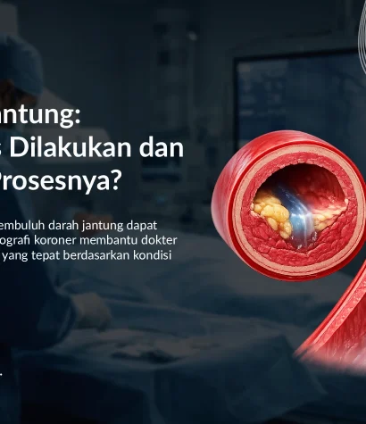 Angiografi Koroner: Kapan Harus Dilakukan dan Bagaimana Prosesnya?