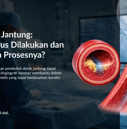 Angiografi Koroner: Kapan Harus Dilakukan dan Bagaimana Prosesnya?