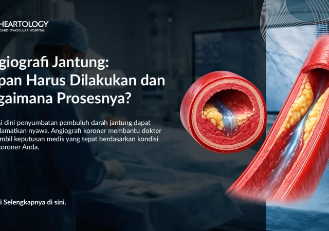 Angiografi Koroner: Kapan Harus Dilakukan dan Bagaimana Prosesnya?