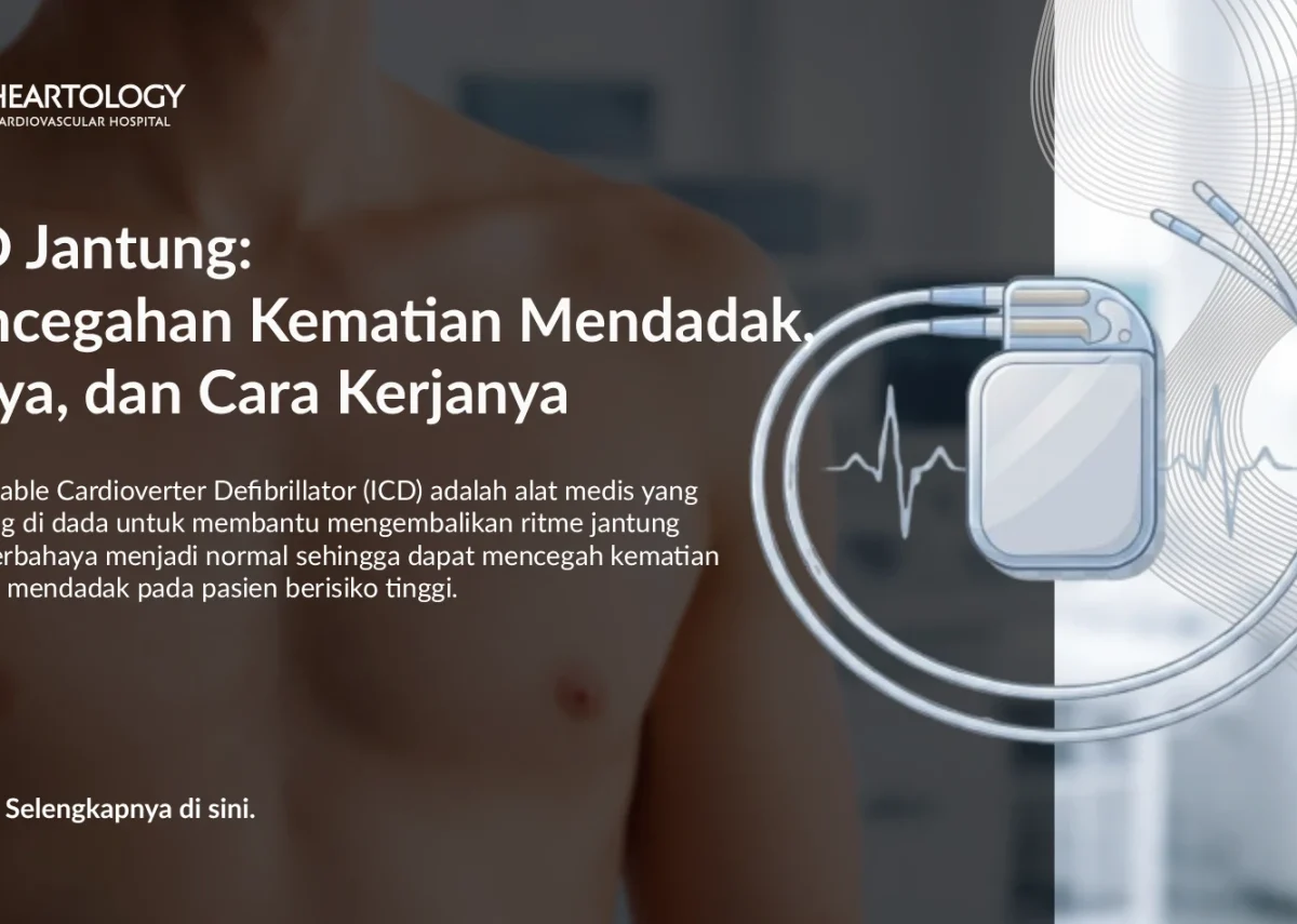 ICD Jantung: Pencegahan Kematian Mendadak, Biaya, dan Cara Kerjanya