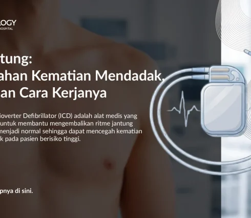 ICD Jantung: Pencegahan Kematian Mendadak, Biaya, dan Cara Kerjanya