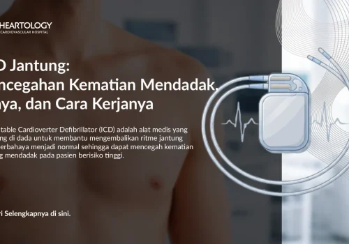 ICD Jantung: Pencegahan Kematian Mendadak, Biaya, dan Cara Kerjanya