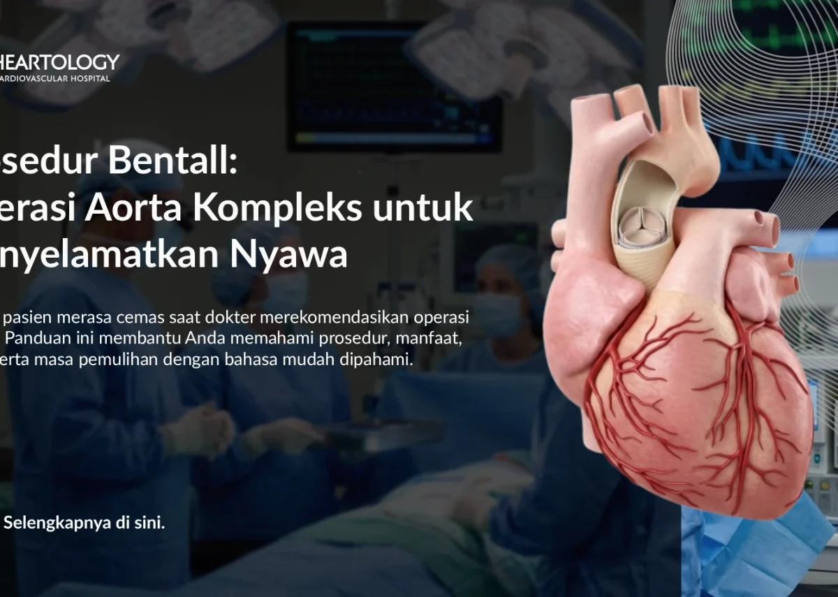 Operasi Bentall untuk Penyakit Aorta: Harapan Baru bagi Pasien