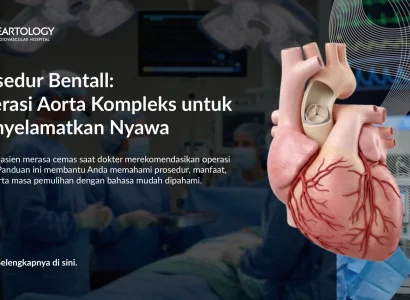 Operasi Bentall untuk Penyakit Aorta: Harapan Baru bagi Pasien
