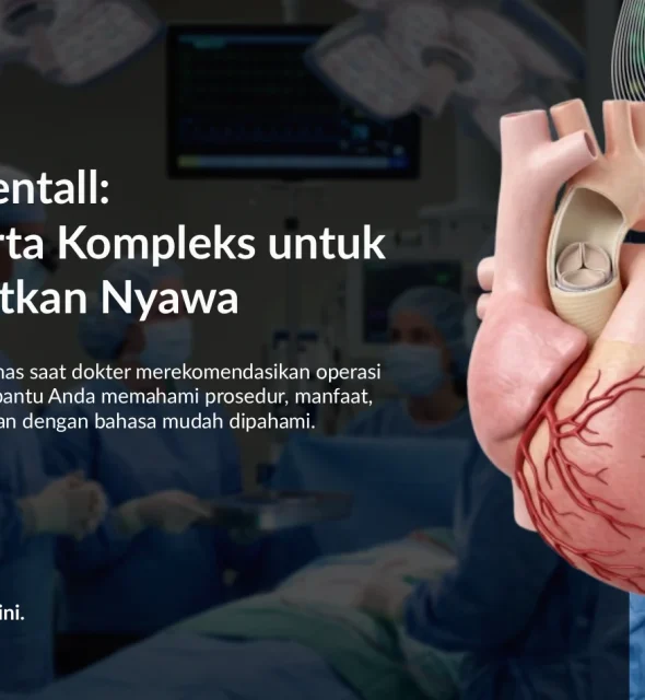 Operasi Bentall untuk Penyakit Aorta: Harapan Baru bagi Pasien