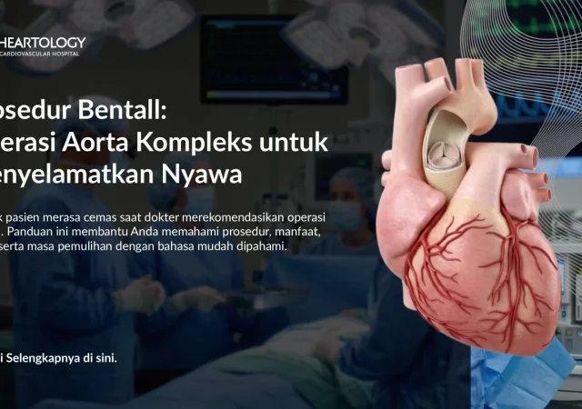 Operasi Bentall untuk Penyakit Aorta: Harapan Baru bagi Pasien