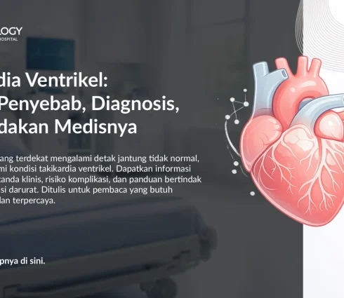 Takikardia Ventrikel (Ventricular Tachycardia): Gejala, Penyebab, Diagnosis, dan Tindakan Medis
