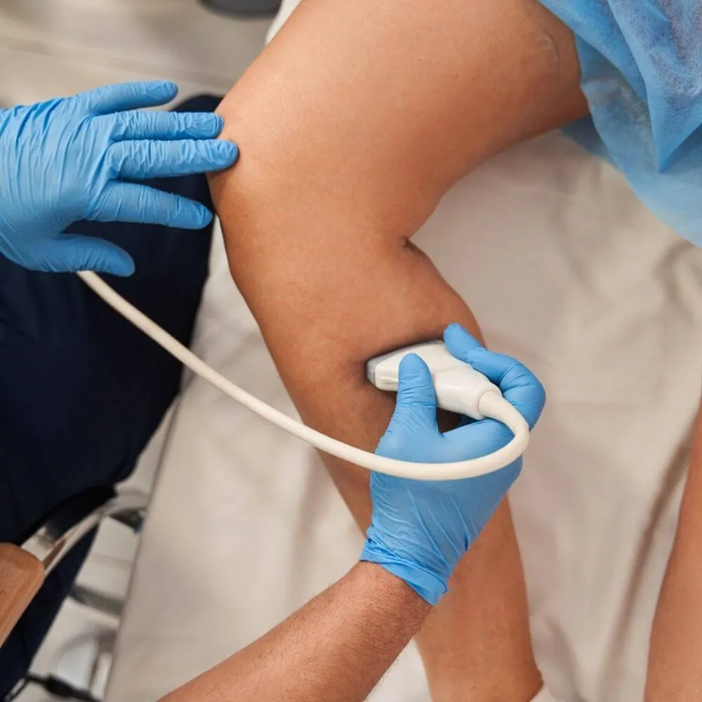 Dokter melakukan pemeriksaan USG Doppler vena pada kaki pasien untuk mendeteksi varises dan gangguan aliran darah