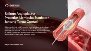 Balloon Angioplasty untuk Sumbatan Jantung: Cara Kerja & Manfaat
