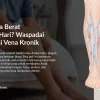 Kaki Berat dan Bengkak: Apakah Ini Insufisiensi Vena Kronik?