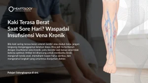 Kaki Berat dan Bengkak: Apakah Ini Insufisiensi Vena Kronik?