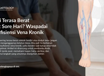 Kaki Berat dan Bengkak: Apakah Ini Insufisiensi Vena Kronik?