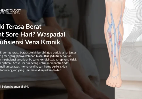 Kaki Berat dan Bengkak: Apakah Ini Insufisiensi Vena Kronik?