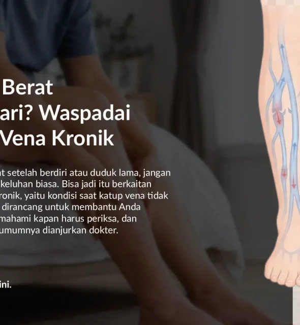Kaki Berat dan Bengkak: Apakah Ini Insufisiensi Vena Kronik?