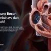 Katup Jantung Bocor Berbahaya? Gejala & Cara Mengatasinya