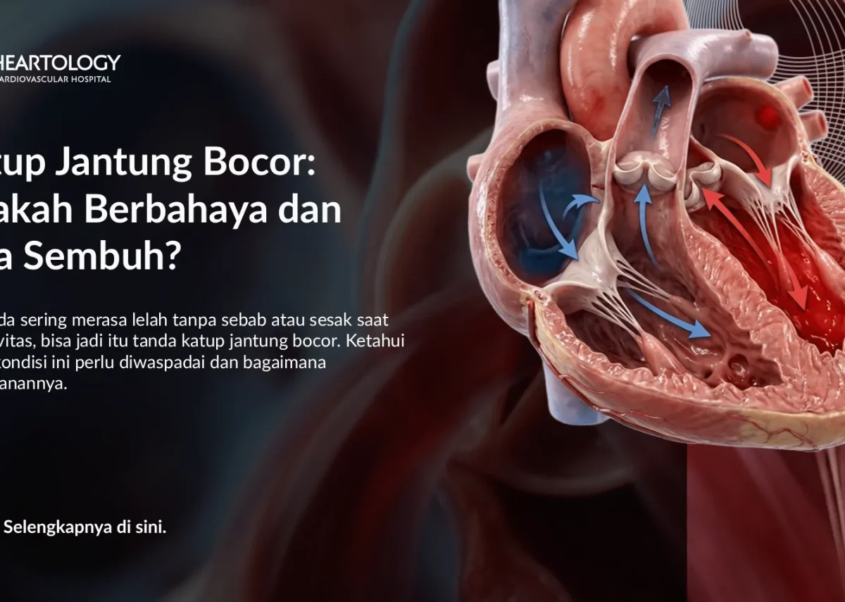Katup Jantung Bocor Berbahaya? Gejala & Cara Mengatasinya