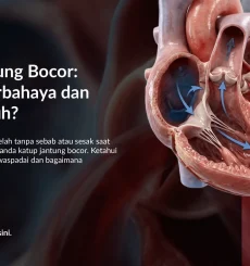 Katup Jantung Bocor Berbahaya? Gejala & Cara Mengatasinya