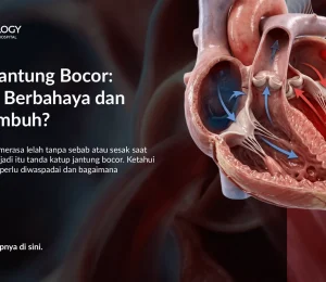 Katup Jantung Bocor Berbahaya? Gejala & Cara Mengatasinya