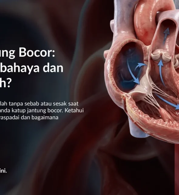 Katup Jantung Bocor Berbahaya? Gejala & Cara Mengatasinya