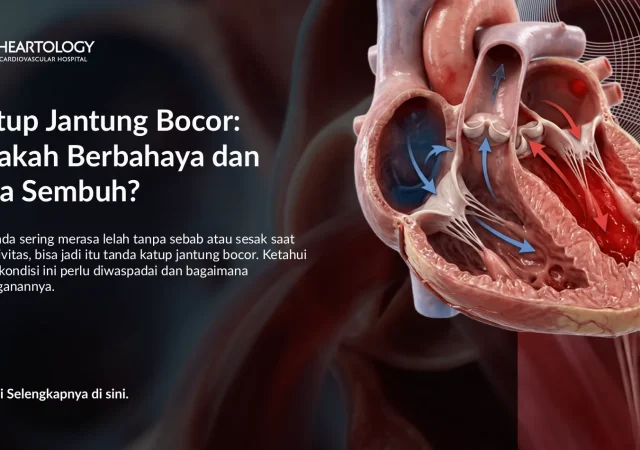 Katup Jantung Bocor Berbahaya? Gejala & Cara Mengatasinya