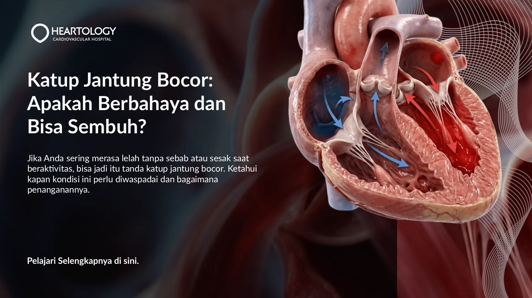 Katup Jantung Bocor Berbahaya? Gejala & Cara Mengatasinya