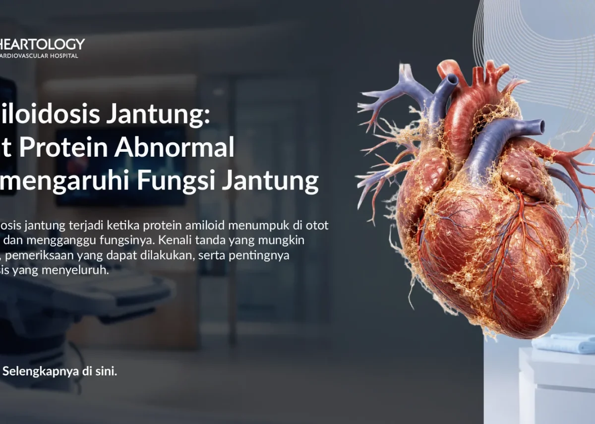 Amiloidosis Jantung: Gejala, Diagnosis, dan Penanganannya