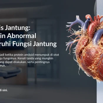 Amiloidosis Jantung: Gejala, Diagnosis, dan Penanganannya