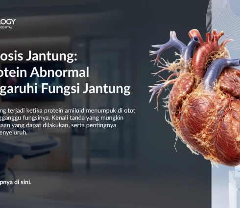 Amiloidosis Jantung: Gejala, Diagnosis, dan Penanganannya