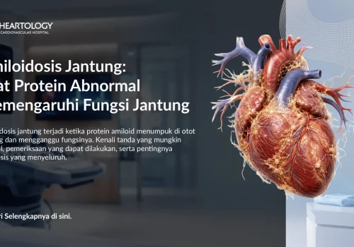 Amiloidosis Jantung: Gejala, Diagnosis, dan Penanganannya