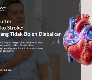 Jantung Berdebar Cepat? Waspadai Atrial Flutter