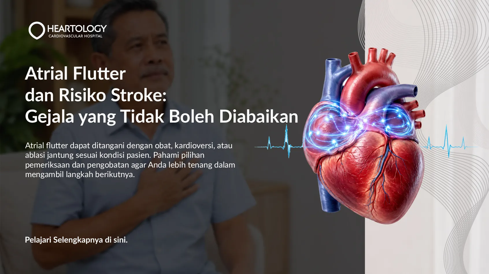 Jantung Berdebar Cepat? Waspadai Atrial Flutter