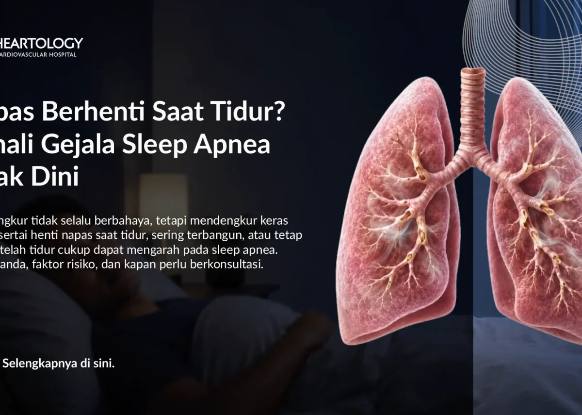 Sering Mendengkur? Kenali Sleep Apnea dan Risiko Jantung