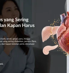 Gejala Lupus yang Sering Diabaikan dan Kapan Harus Tes