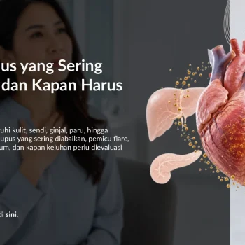 Gejala Lupus yang Sering Diabaikan dan Kapan Harus Tes